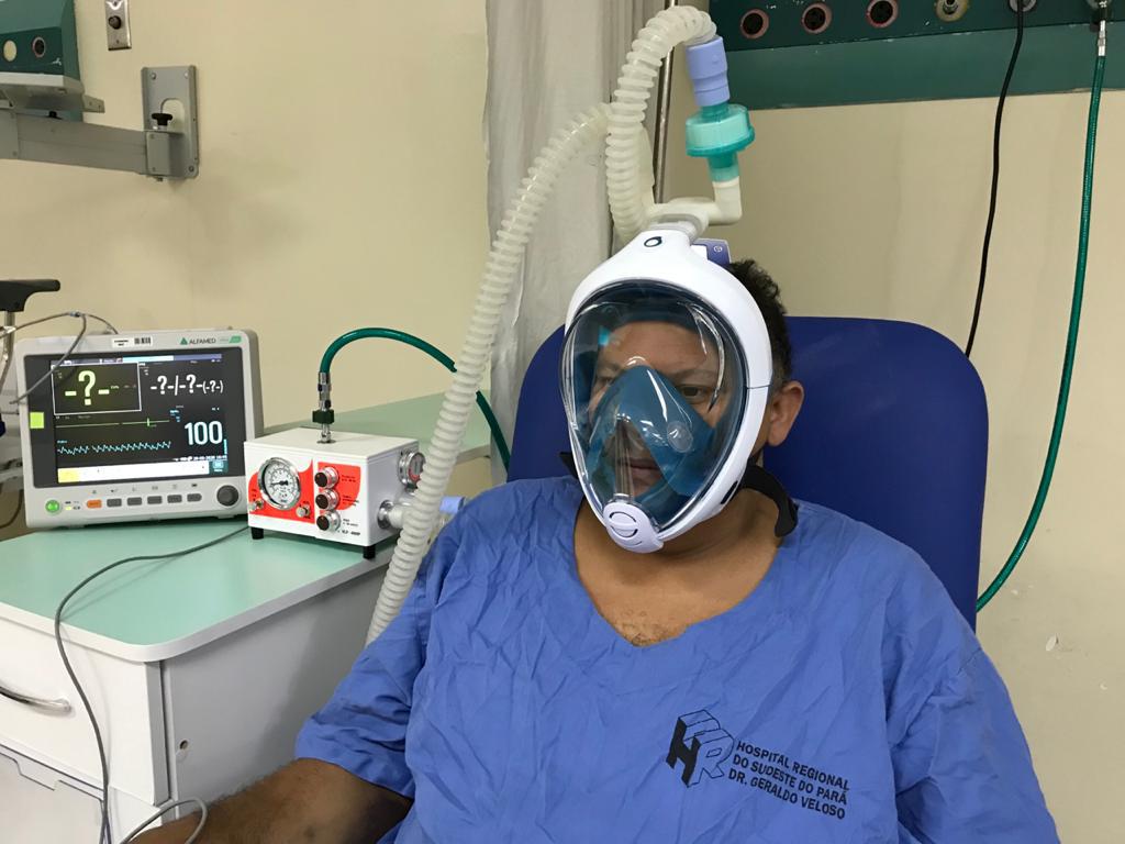 Hospital Regional do Sudeste do Pará utiliza máscara de mergulho no tratamento da Covid-19