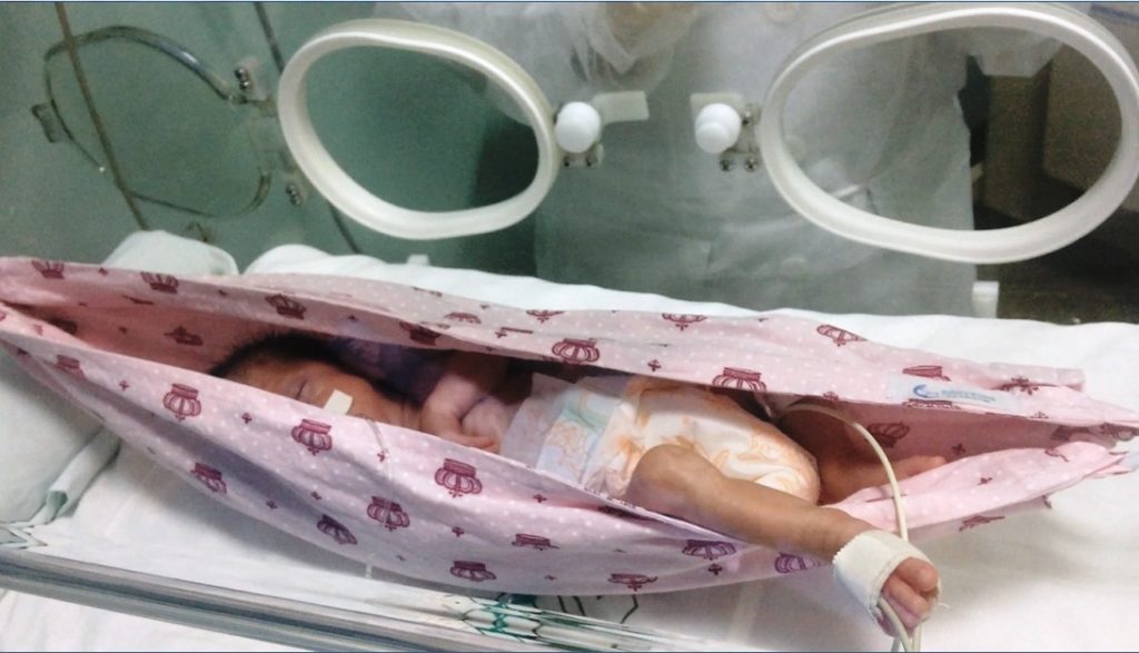 Programa terapêutico do Hospital Regional do Sudeste do Pará implanta redes de balanço nas incubadoras da UTI neonatal