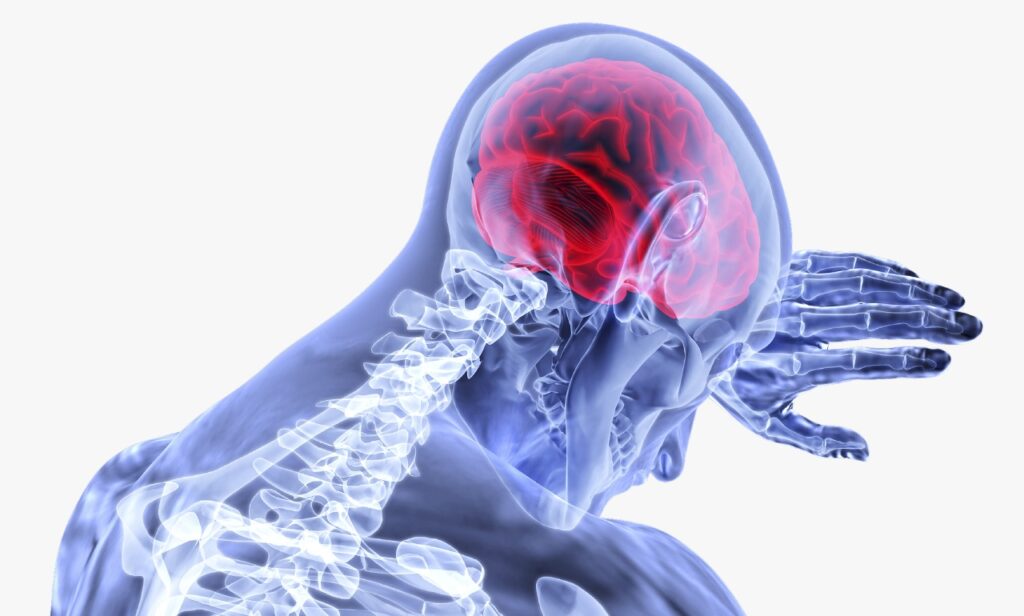 Saiba identificar sinais de um derrame cerebral