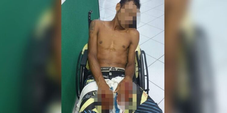 'Flanelinha' é baleado nas mãos por integrantes de 'tribunal do crime' no Pará