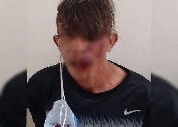 Polícia prende filho que agrediu o pai com tijolada
