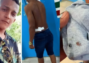 Jovem tenta correr de assalto e acaba baleado nas costas