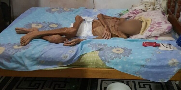 Idoso morre após ser torturado pelos filhos em Abaetetuba