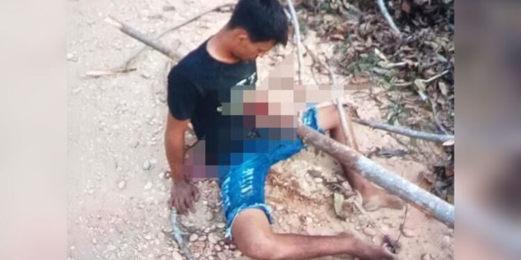 Jovem fica com tronco atravessado no peito após acidente com moto