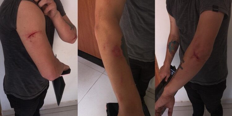 Homem é agredido a tijoladas por ex no Pará