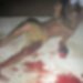 Homem de 29 anos é esfaqueado no bairro da Paz em Itaituba