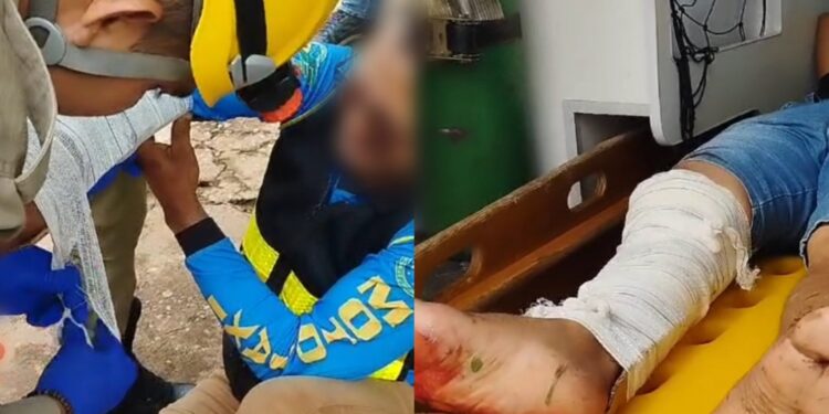 Vídeo: Acidente na Estrada do Bis em Itaituba Deixa Motociclistas Feridos Vídeo: Acidente na Estrada do Bis em Itaituba Deixa Motociclistas Feridos