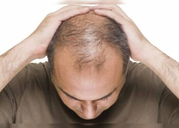 Proteína é nova esperança para o fim da calvície