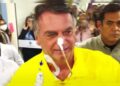 Cirurgia de desobstrução intestinal de Bolsonaro já dura mais de 8 horas