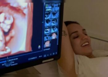 Rafa Kalimann fala sobre mudanças no corpo na gravidez